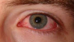 Աչքերը շատ բան կարող են ասել  ձեր հիվանդության մասին